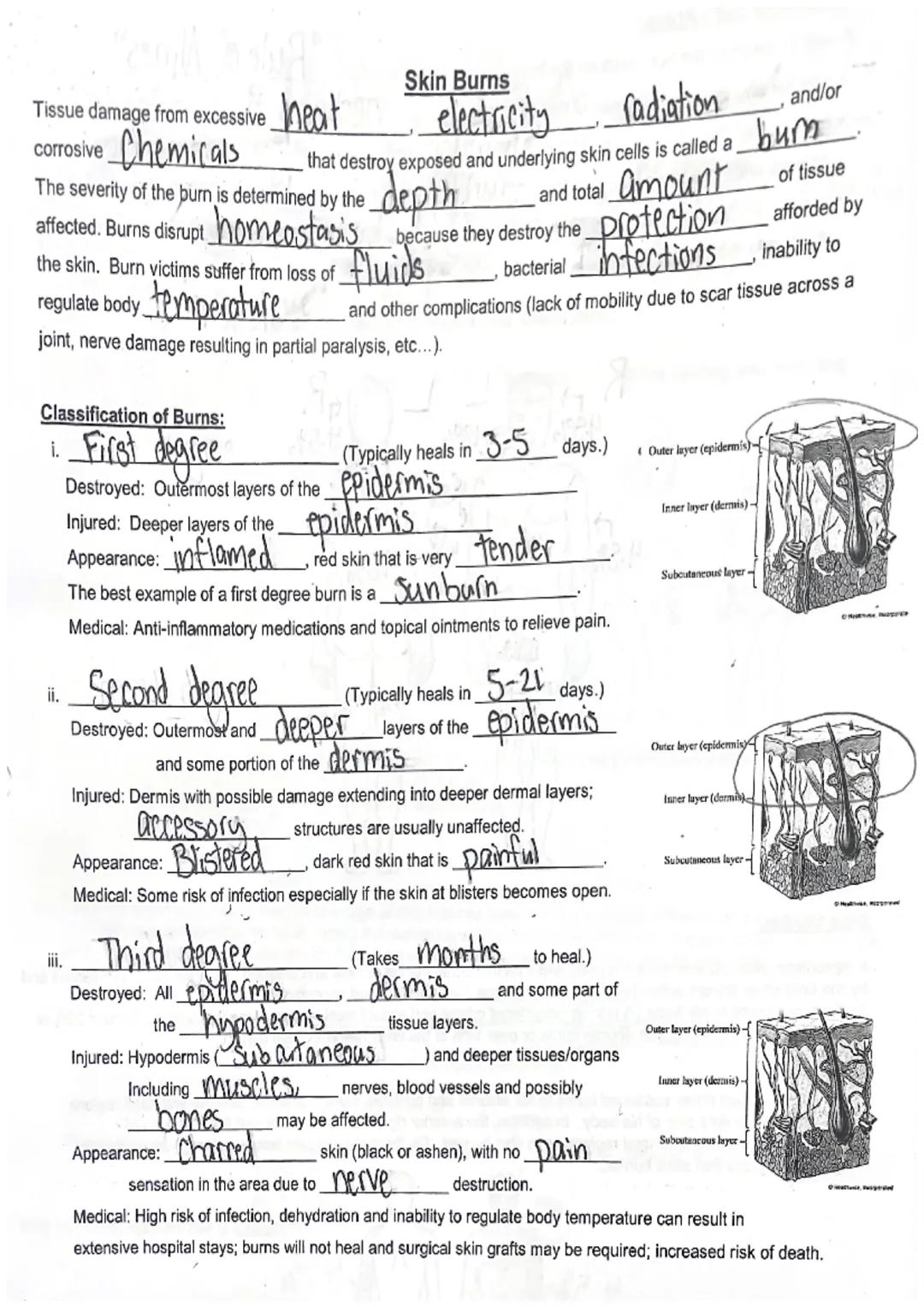 # Skin Burns
Tissue damage from excessive heat electricity radiation and/or
corrosive Chemicals that destroy exposed and underlying skin cel
