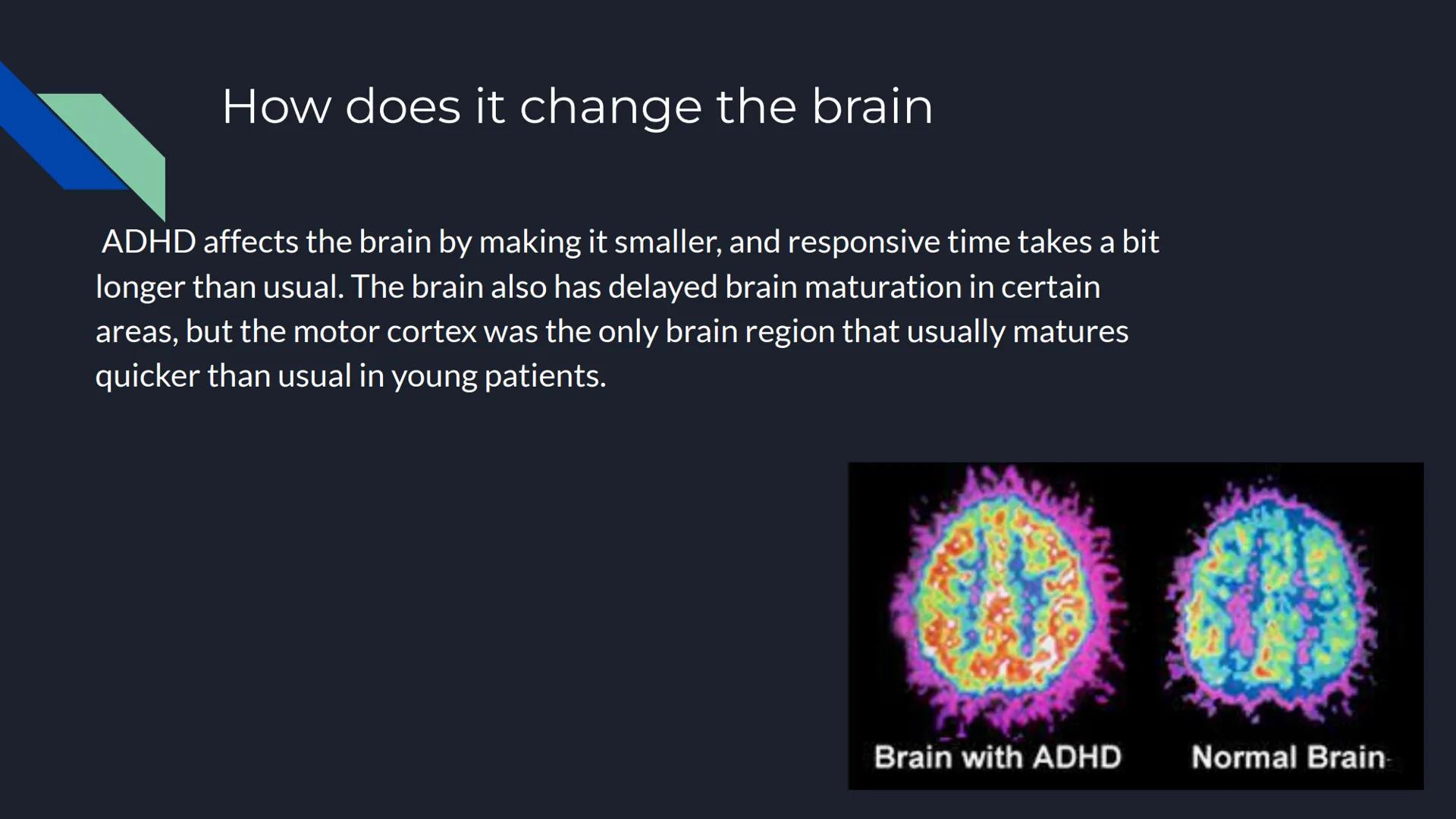 # Case Study on
ADHD

Chelsea Ngokwere # Patient's History

Name: Flora Crowder

Age: 19

Gender: Female

High

Low

Control Subject

ADHD S