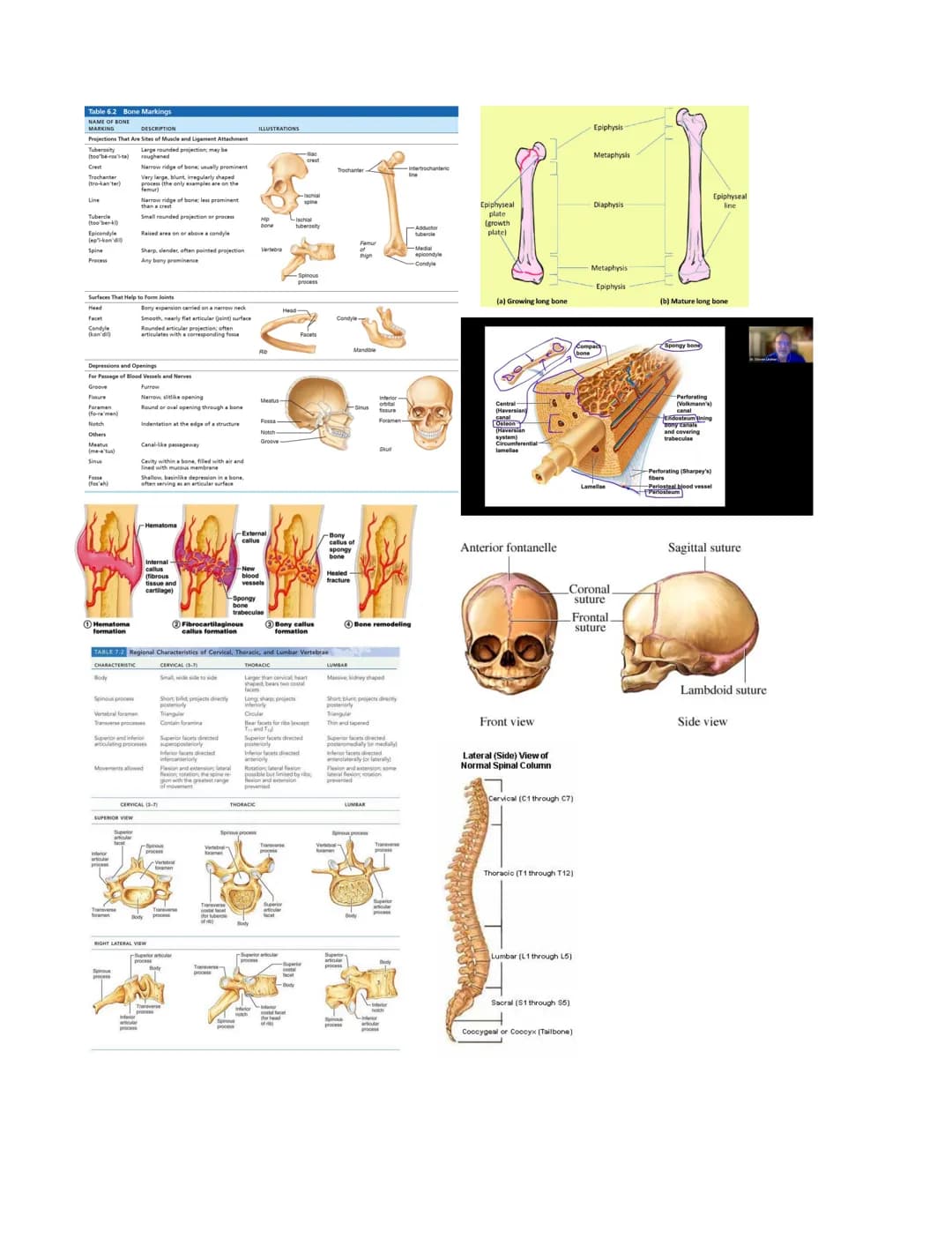 
<p>Long bones serve the purpose of providing strength, structure, and mobility. The femur, or thigh bone, is an example of a long bone. Des