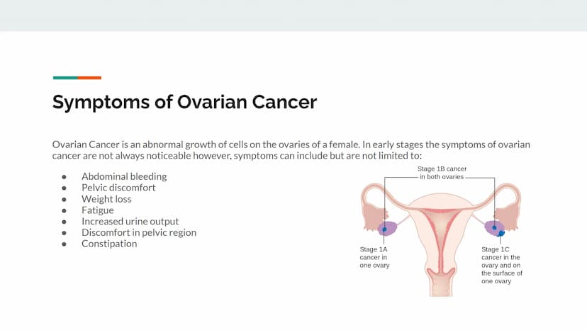 Natural History of Ovarian
Cancer
A presentation by Nicole Guevara Symptoms of Ovarian Cancer
Ovarian Cancer is an abnormal growth of cells 