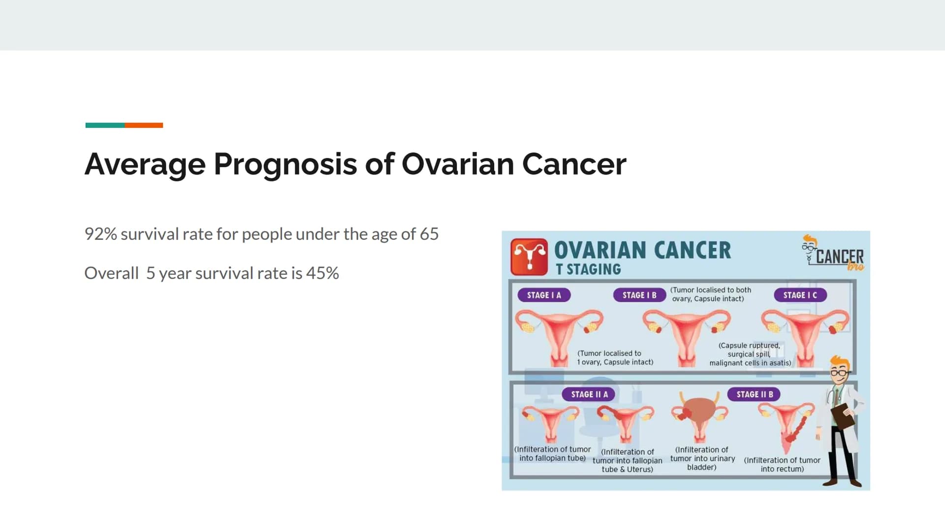 Natural History of Ovarian
Cancer
A presentation by Nicole Guevara Symptoms of Ovarian Cancer
Ovarian Cancer is an abnormal growth of cells 
