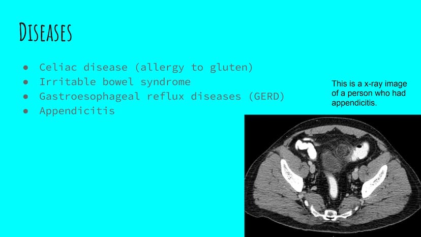 THE DIGESTIVE SYSTEM PHARYNX ²
at the beginning
of the throat. both food
and
through it.
travel
EPIGLOTTIS: flap of
over
the
muscle that clo