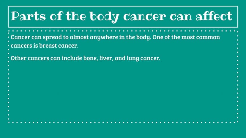 ■
I
■
■
■ ■
■
■
■
Cancer
■
■ Cancer
• What is cancer? Cancer is a disease where cells abnormally grow; They can
▪ spread to other parts of t