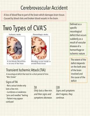 Know Anatomy and Physiology cerebral vascular accident  thumbnail