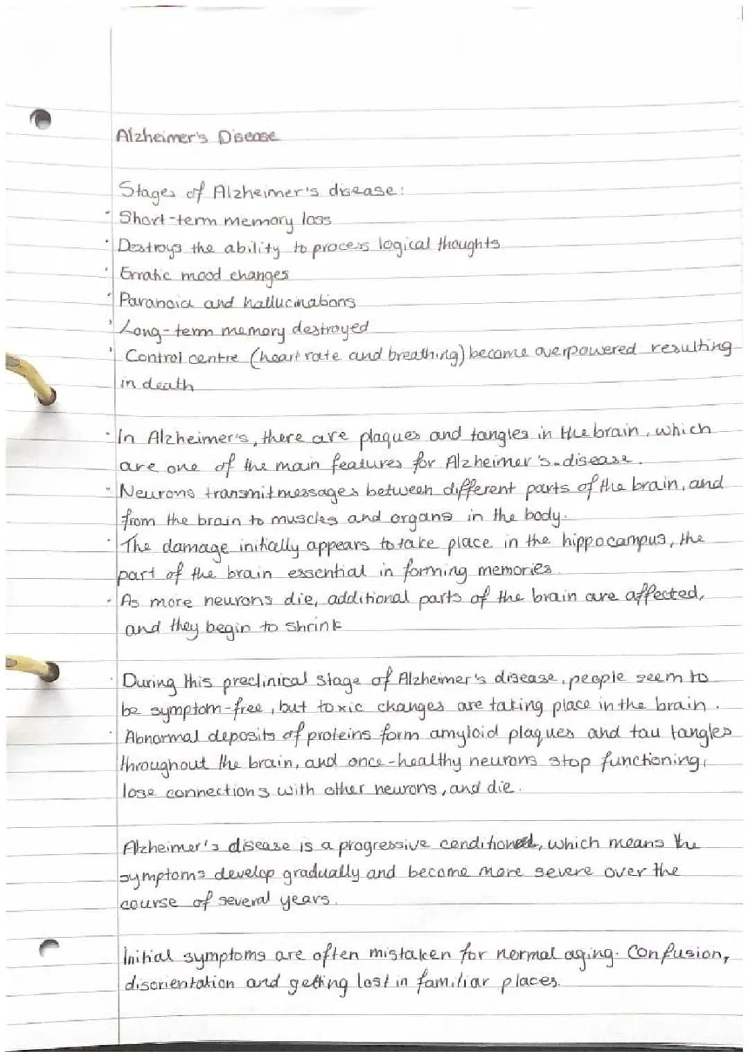 Understanding Stages of Alzheimer's and What to Look For