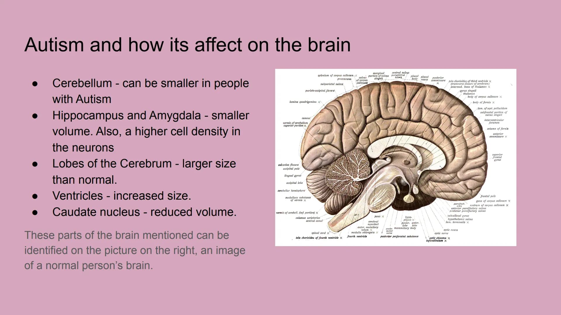 
<p>Autism, also known as ASD or Autism Spectrum Disorder, is a developmental disorder that affects the growth of communication skills and s