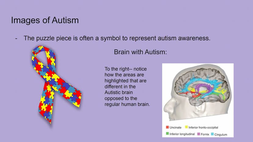 
<p>Autism, also known as ASD or Autism Spectrum Disorder, is a developmental disorder that affects the growth of communication skills and s