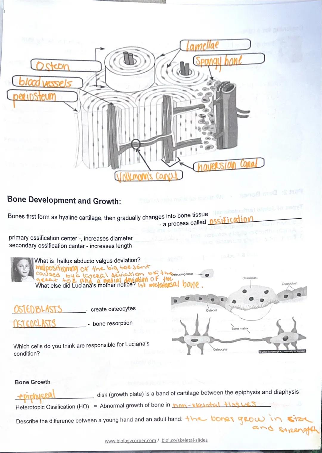 SKELETAL SYSTEM
Case: Luciana
Google Slides
Describe Fibrodysplasia Ossificans Progressiva (FOP)
FUNCTIONS- support and protection; body mov